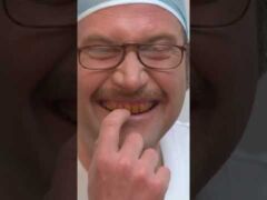 Le PIRE des dentistes ! #shorts